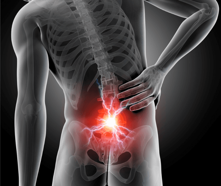 Sacroiliac Pain Dysfunction MyChiro Bondi Junction Chiropractor in